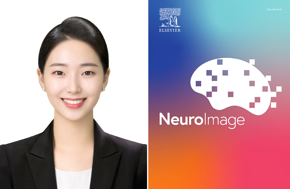 바이오메디컬공학부 이가원 박사과정생, 세계적 저널 NeuroImage에 AI 기반 MRI 정규화 기술 논문 게재 대표이미지